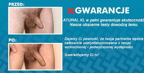 penis z erekcją penis w stanie leżącego